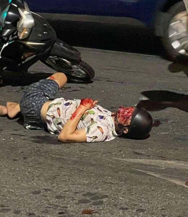 Lost his face
