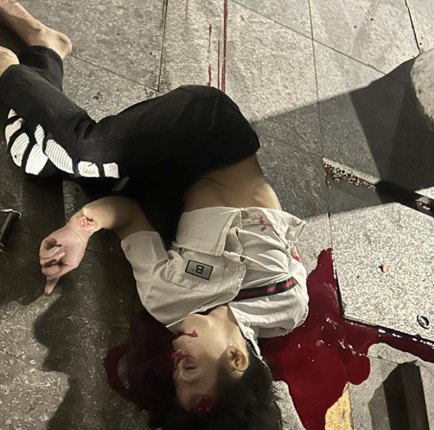 Crash between 2 motorcycles: 2 dead and one seriously injured 3