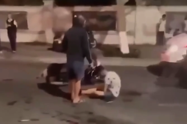 Lost his face