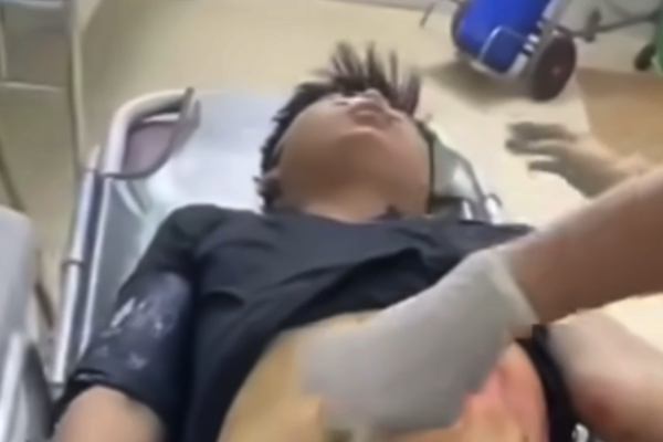 Intestines exposed after stabbing